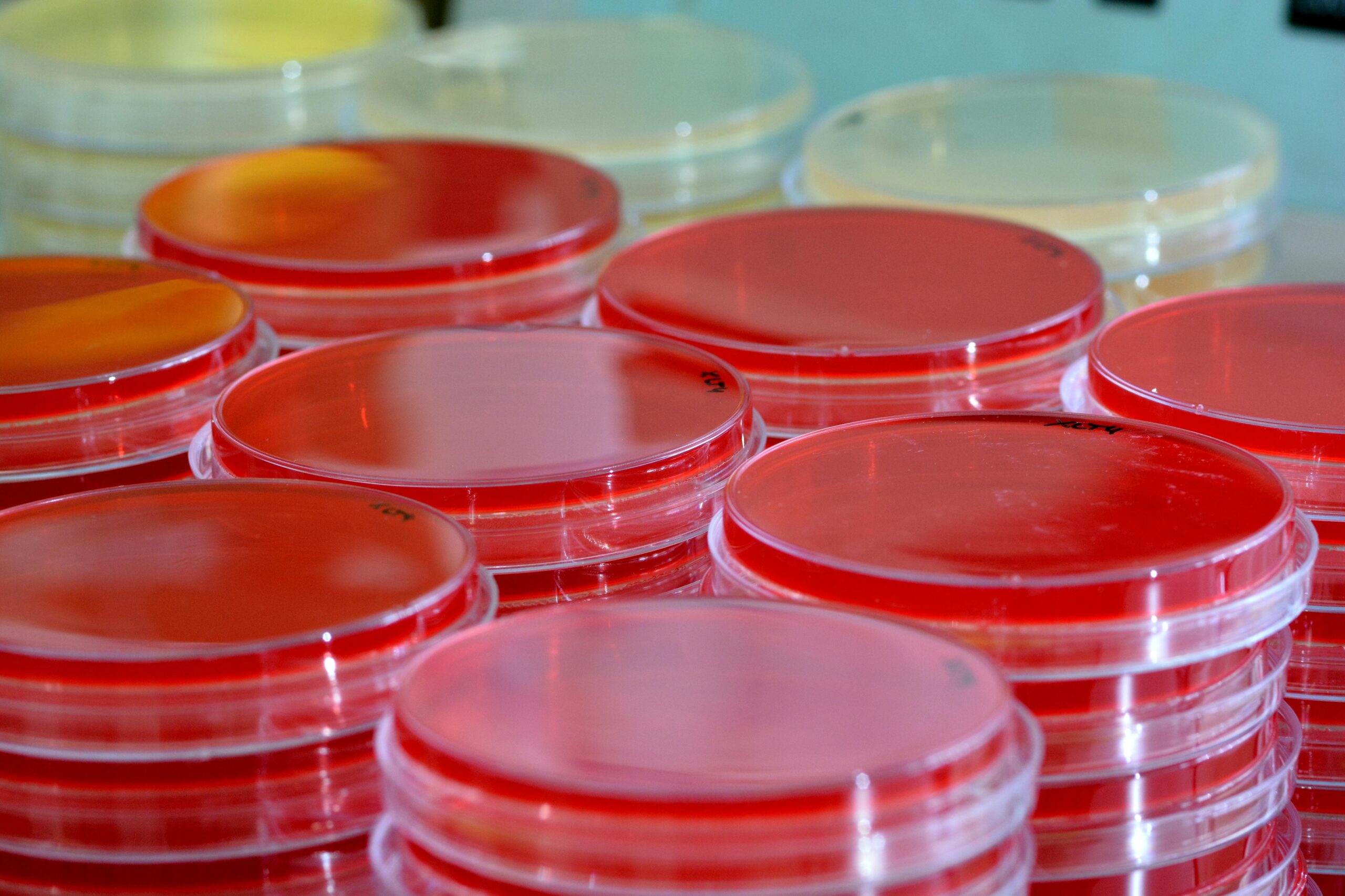 agar microbiology