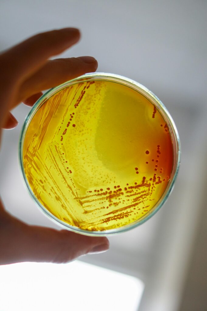 agar microbiology