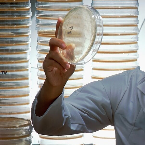 agar microbiology