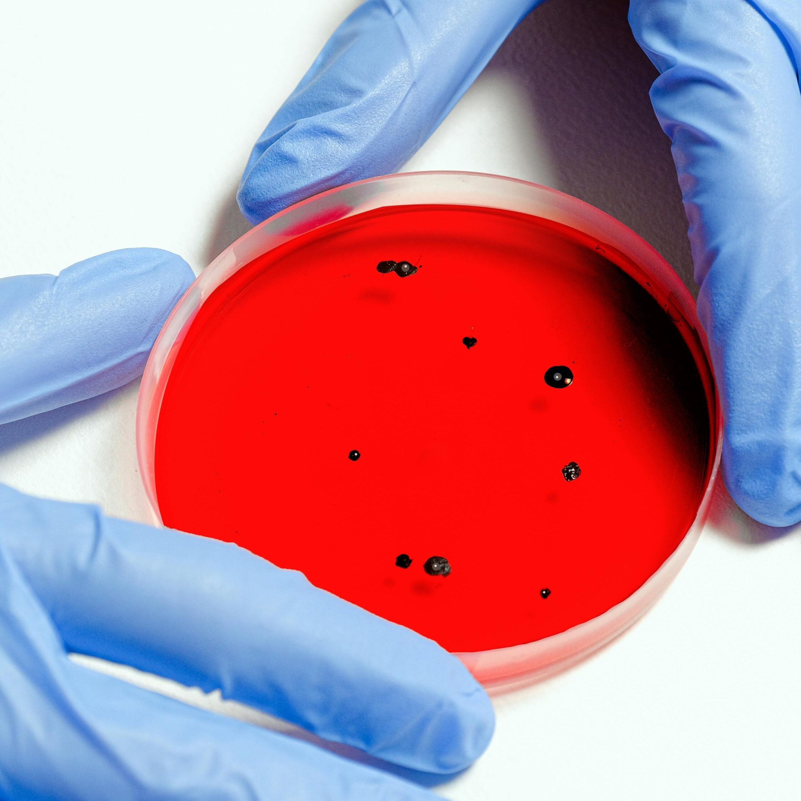 agar microbiology